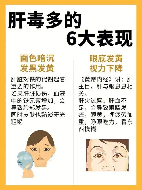 60肝毒多的6大表现眼黄口臭面色暗黑