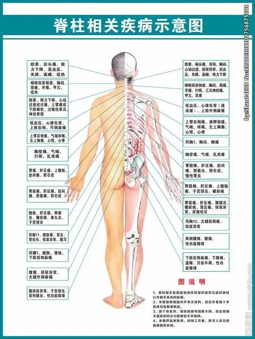 脊柱相关疾病示意图图片