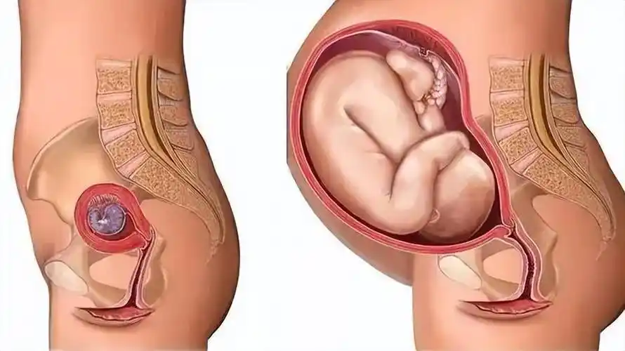 儿媳生二胎后肚子依旧很大,产后身材多久能恢复?_妈妈_巴图_子宫