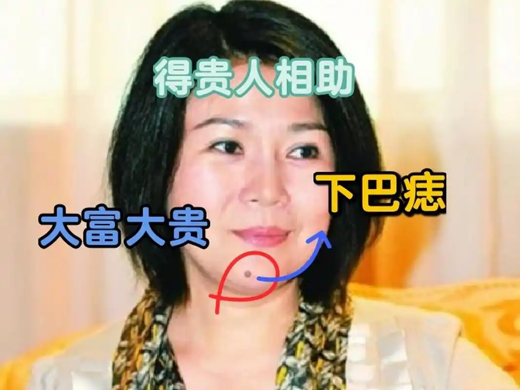 面相|下巴痣,大富大贵 俗语有云:下巴有痣吃遍八方.