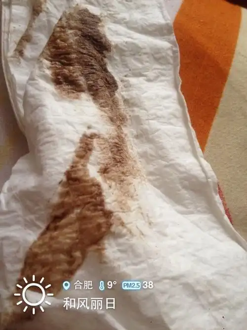 月经好推迟提前.不正常.颜色均属于这样!以下图片.我该怎么办