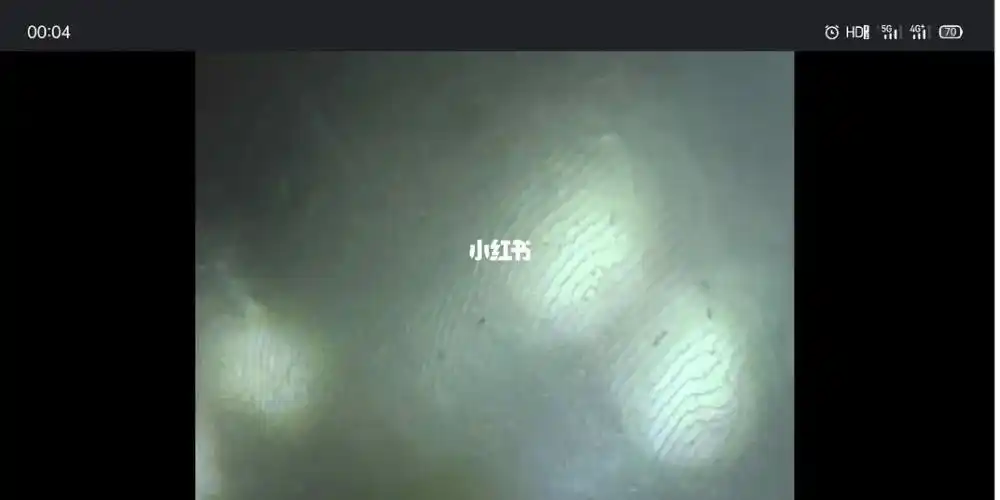 显微镜下看珍珠生长纹