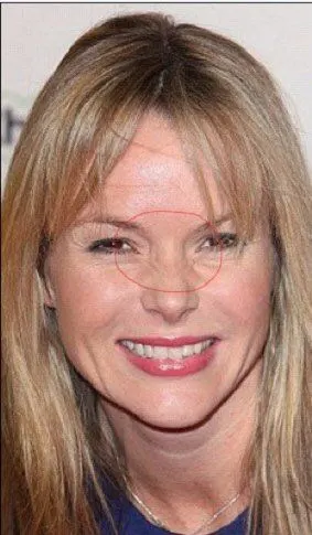 从面相来讲鼻梁长横纹容易破财,且感情婚姻多不顺 从表情管理来讲