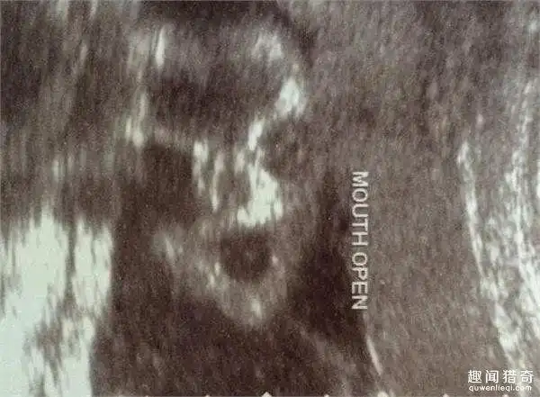 准妈妈去体检,看到b超下的婴儿差点吓哭!