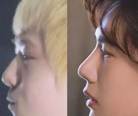 王一博昔日旧照对比太大被网友质疑整容扬言像换了一个人