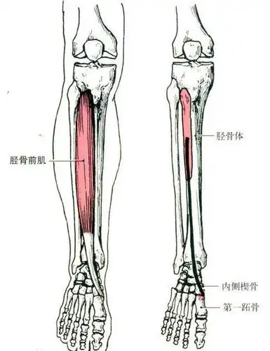 足外翻的自我矫正