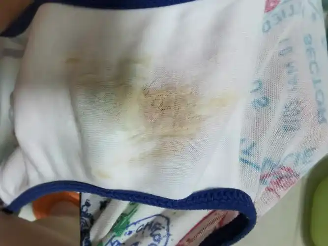 有没有宝妈13周77白带颜色偏黄,偶尔流出黄色的奶状 | 妈妈网轻聊