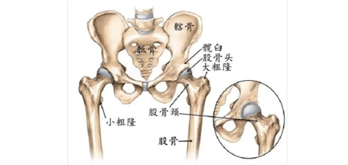 预防股骨头坏死请检测骨密度值_骨密度分析仪,人体成
