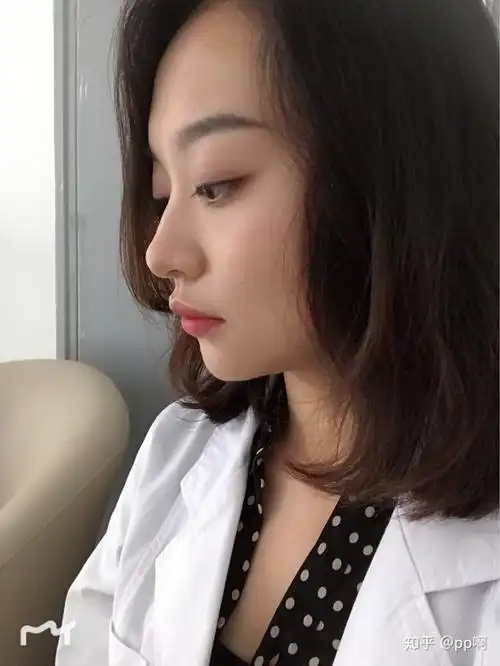 我的上嘴唇有点翘,会不会看起来很奇怪,不好看啊,从小就被大人说喜欢