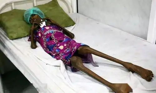 如果没有恰特草,如果没有战争,就没有瘦得皮包骨的饥饿女孩,也没有