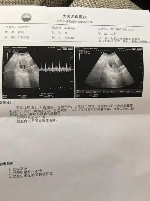 科学严谨!孕囊大小对照表"不堪盈手赠"-第1张图片-康夫博客
