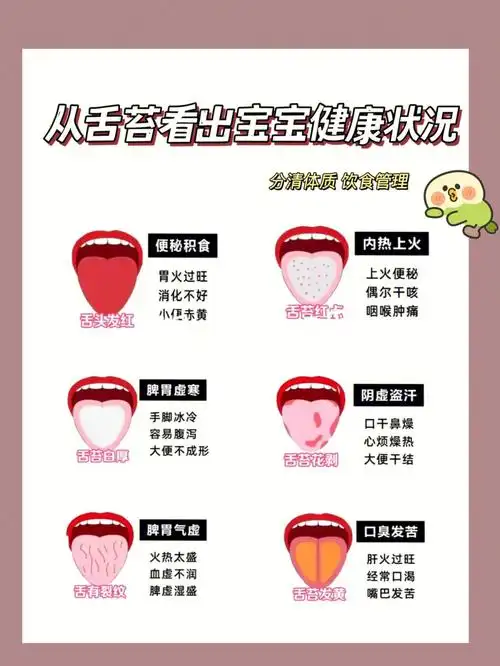 健康舌苔92舌苔应该是这样:76,舌面为淡粉色舌面是淡粉颜色,不白