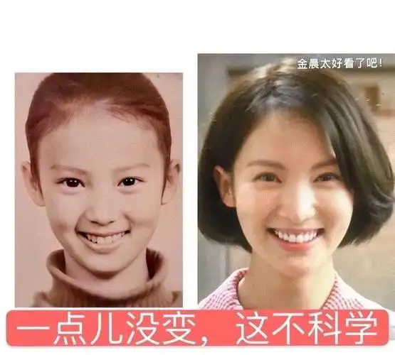 金晨的鼻子是角度的问题,整没整过容,看她小时候你就知道了