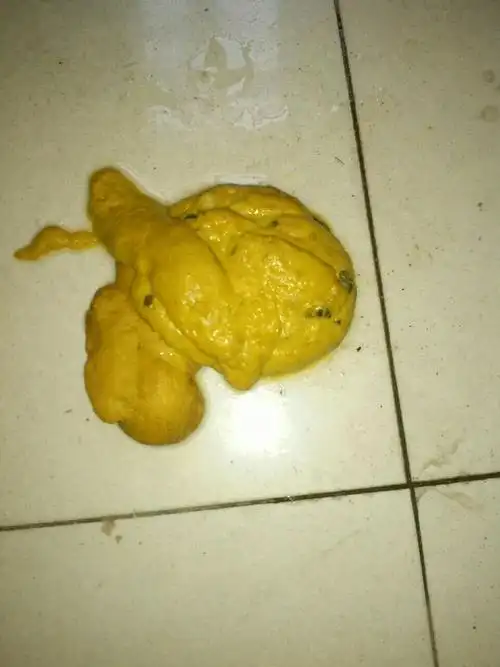 宝宝拉屎比较稀怎么办