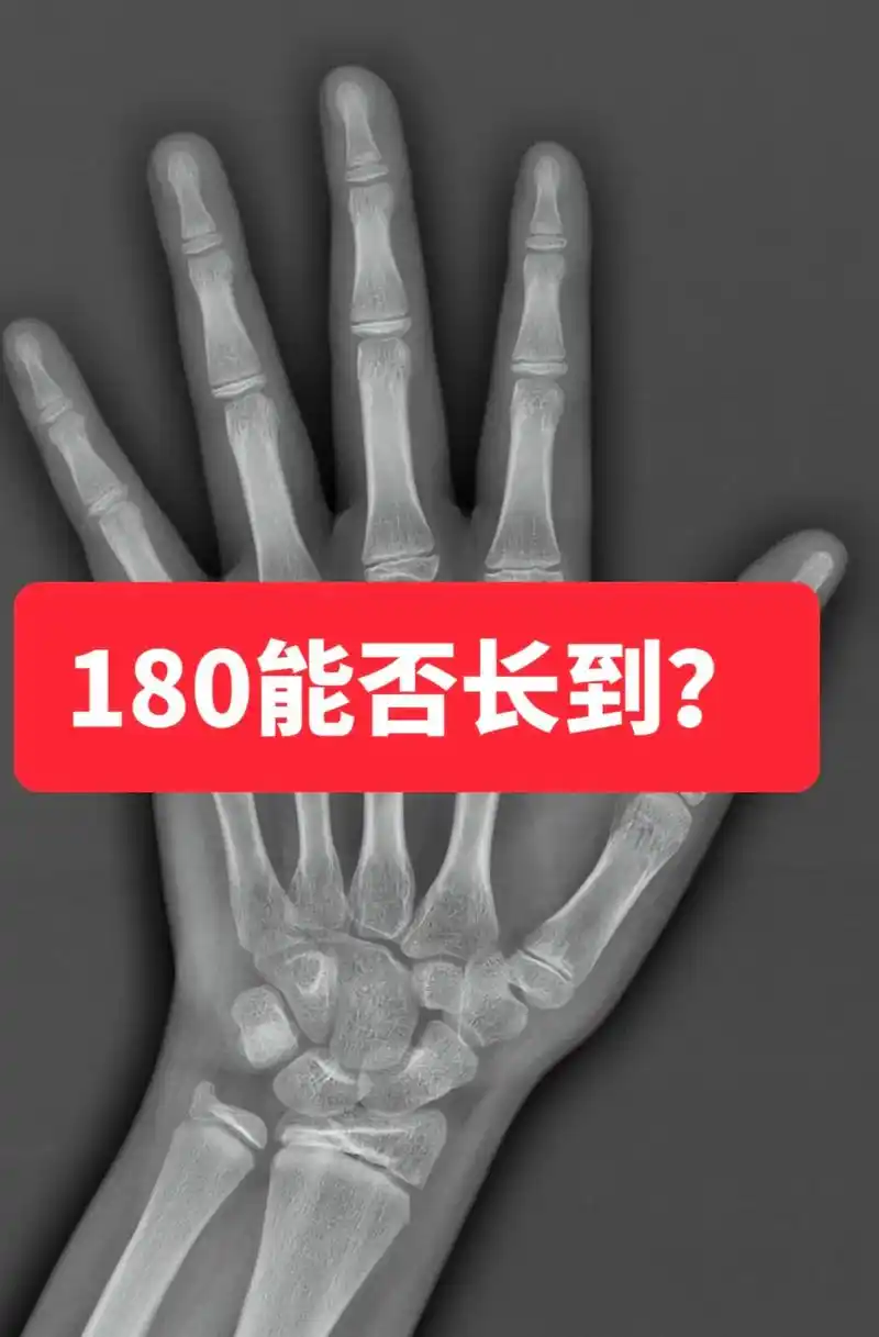案例:13岁 5个月男孩,身高157. - 抖音