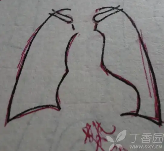 【求助】普大型心,梨形心,靴形心的片子究竟怎么看啊