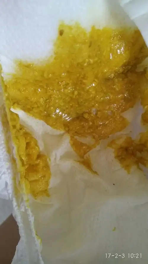 新生儿之拉肚子以及攒肚子_小猪生活-武汉猪小侠网络科技有限公司