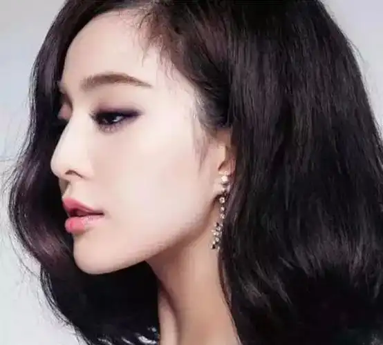 鼻子变挺才最好看!