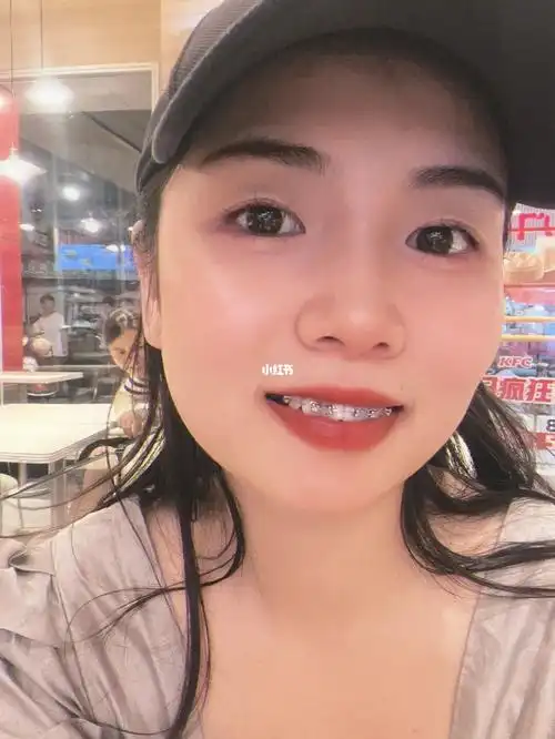 这小牙套可真别致