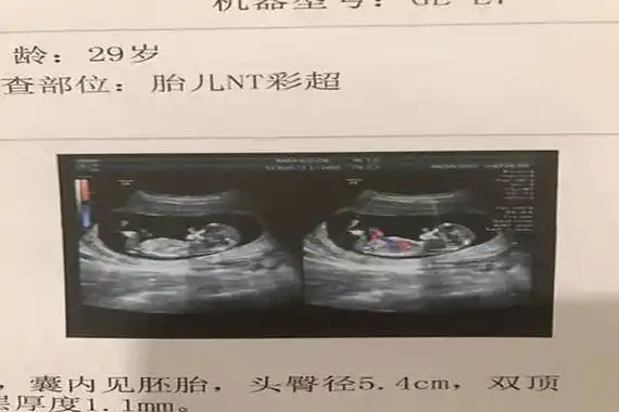 nt测值看男女准确率高达80这2个数据你看对了吗