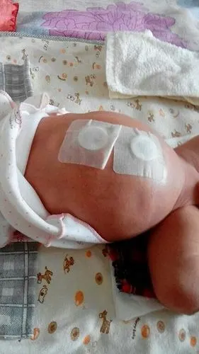 宝宝肚子胀气?是不是你造成的?赶快看看原因学习解决办法