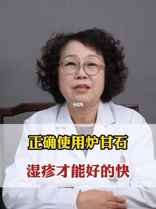 炉甘石治湿疹的正确用法你知道吗