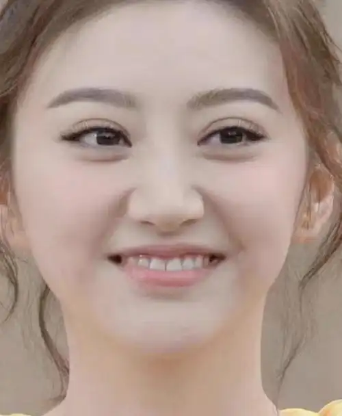 景甜双眼皮修复前后对比,变化惊人!