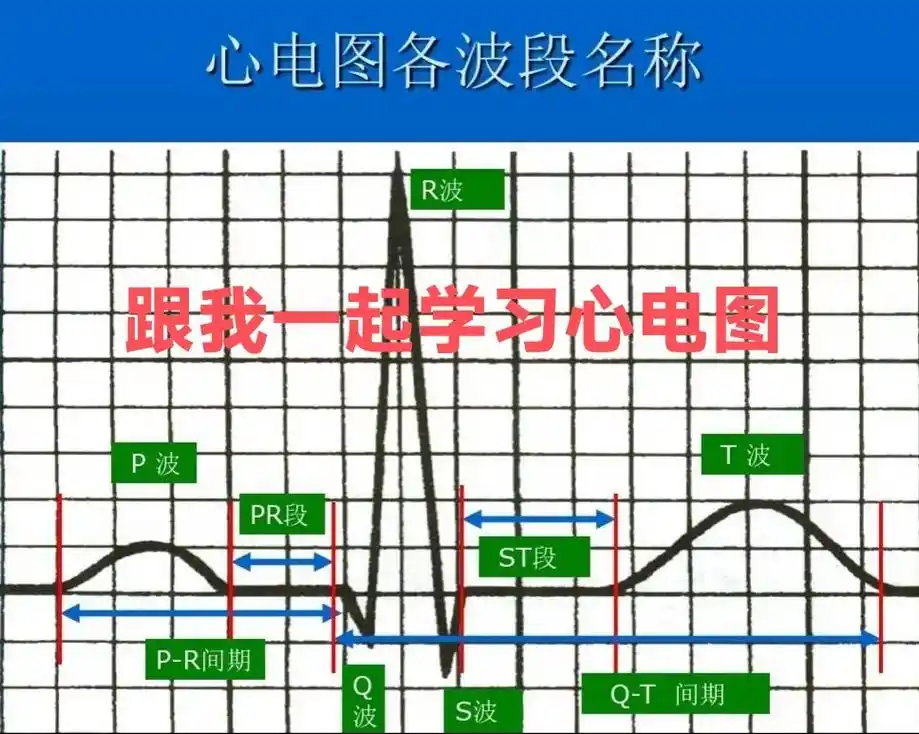 看心电图:从复杂到最简单.#学习辅导资料 - 抖音
