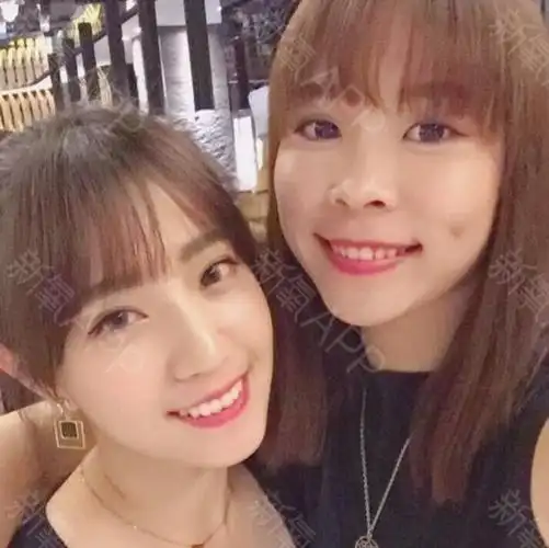 酒窝好看还是梨窝好看?