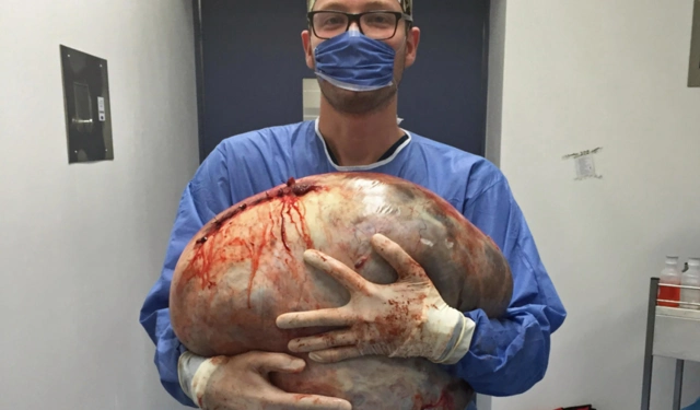 图中,这名24岁女子挺着一个巨大的肚子,肚子上满是妊娠纹,你可能会想