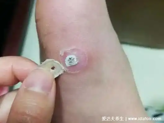 很简单了,在药店,网上都可以买到,按照说明书上面的方法,把脚洗干净