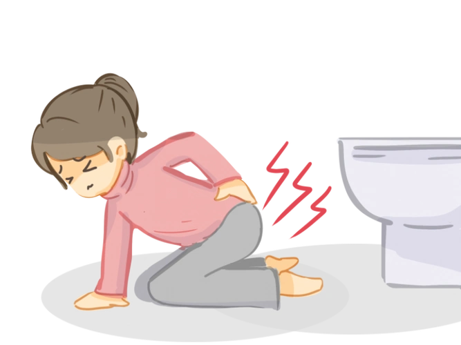 产后大便失禁_医联媒体