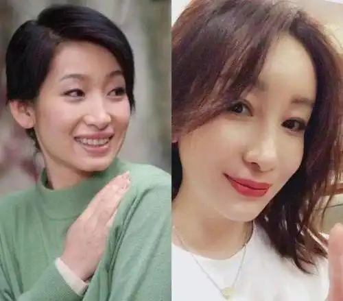 她们承认割了双眼皮,戚薇很霸气,但秦海璐的原因令人心疼!