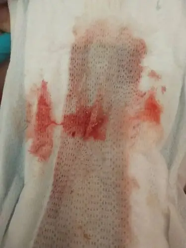 你们来月经有黏黏的东西吗