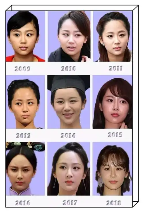 杨紫整容了吗杨紫整容史