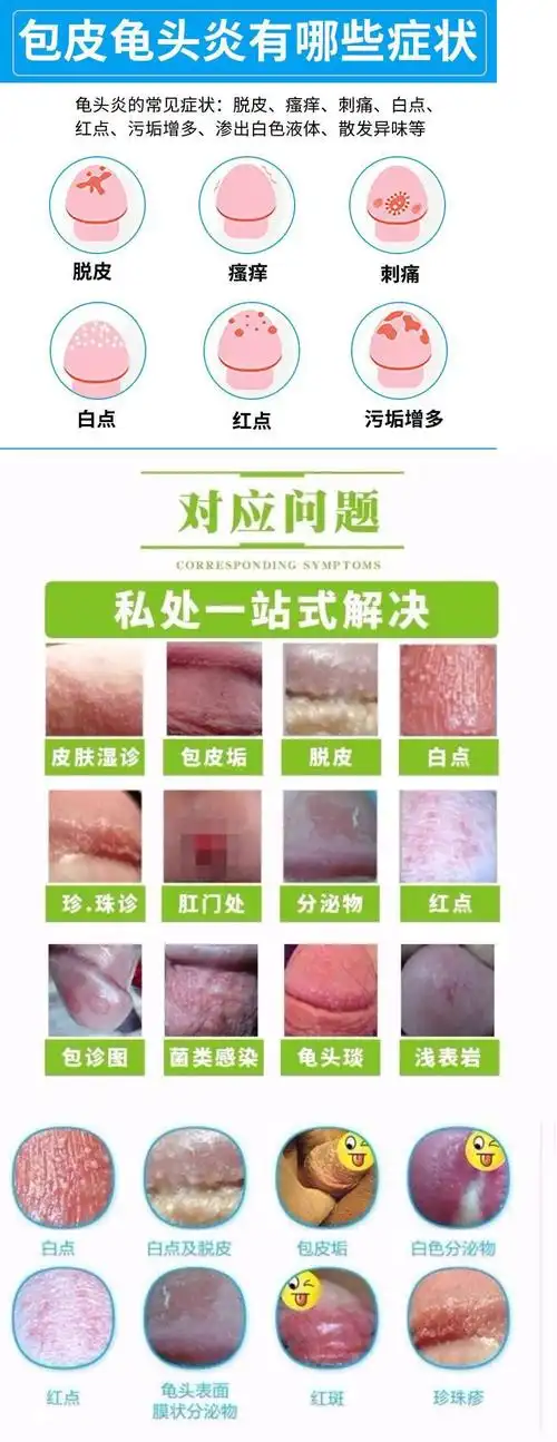 妍叶堂龟炎清男士私处瘙痒红肿红点珍珠止氧