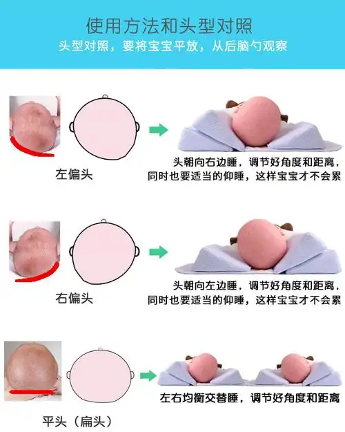 的枕头婴儿定型枕宝宝纠正头型枕新生儿侧睡枕防偏头尖头扁平头0-1岁