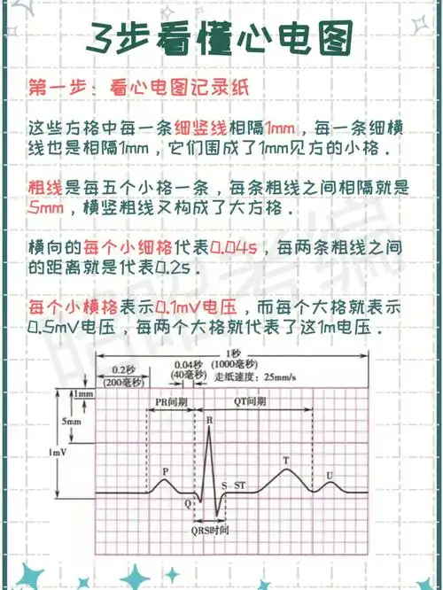 只需366步手把手带你看懂心电图看完上岸