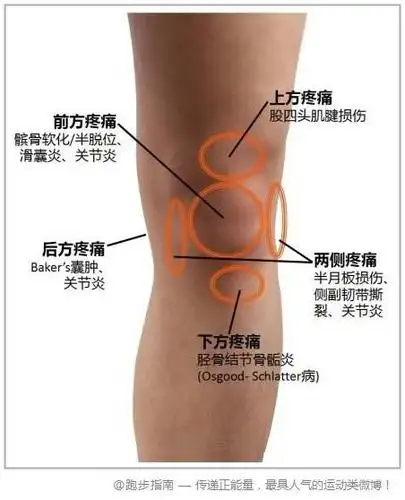 转发微博【转发】@跑步指南:【膝关节疼痛. 来自在路上的87 - 微博