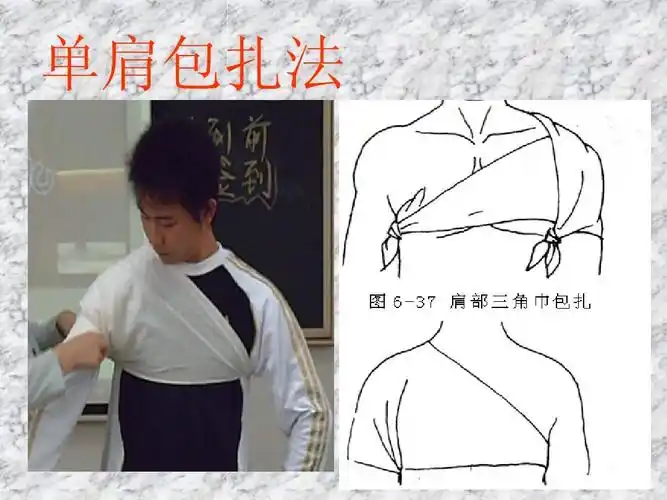 急救培训-三角巾包扎