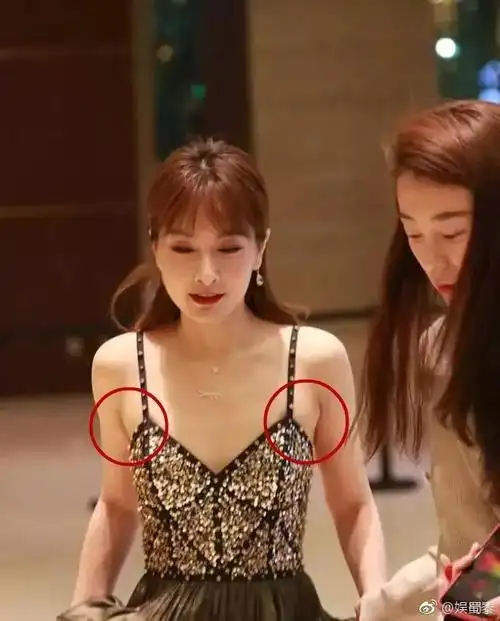 其实所谓的副乳就是腋下多出的两坨肉肉,分 先天性和后天性两种.