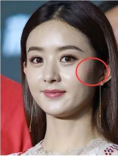 请扣p图师鸡腿!赵丽颖参加名媛活动,硬是把大脓痘p成了大块色斑?