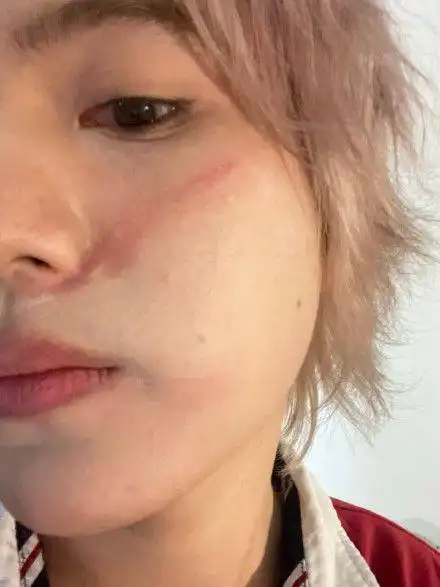 尹毓恪深夜自曝被焦迈奇扇脸:挺寒心的