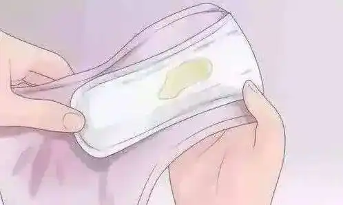 01,白色分泌物在经期开始或结束时,出现一点白色或乳白色分泌物是正常