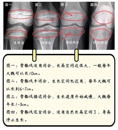 铜川去医院看骨骺线要多少钱