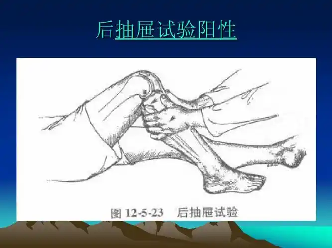 膝关节后交叉韧带损伤ppt_word文档在线阅读与下载_无忧文档