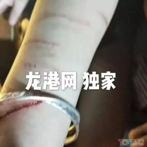 女生自残割手腕图片 - 搜狗图片搜索
