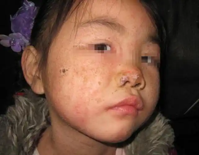 的女儿今年4岁了,小时候刘辉女儿还长的挺好看的,但是越长大就越难看