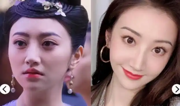 景甜眼皮太宽被称悲伤蛙越来越多明星承认整容人工美女并没错