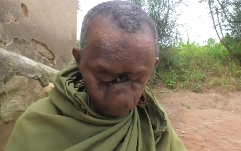 这不是特效非洲这位老奶奶面目全非她表示生来就这般模样